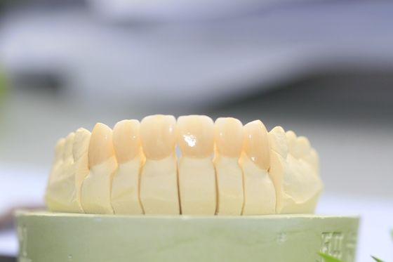 Крона большего Zirconia контура Biocompatibility полного зубоврачебная для зубоврачебной лаборатории