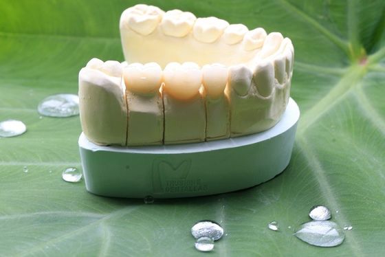 Крона большего Zirconia контура Biocompatibility полного зубоврачебная для зубоврачебной лаборатории