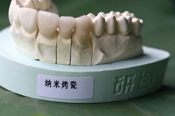 Крона ISO13485 хорошая Biocompatibility PFM не драгоценная зубоврачебная