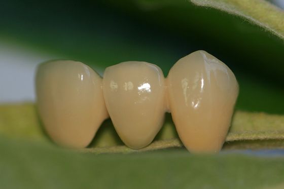 Крона зубоврачебного Zirconia ISO13485 лаборатории дизайна полностью керамического зубоврачебная для Anterior зубов