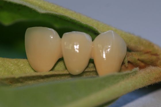 Крона ISO13485 хорошая Biocompatibility PFM не драгоценная зубоврачебная