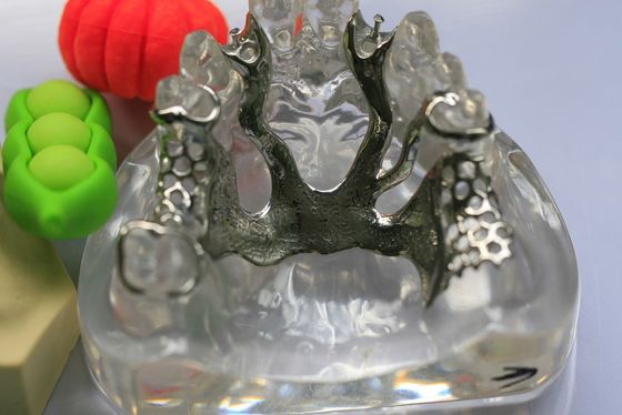 Рамки металла Denture Co Cr частично