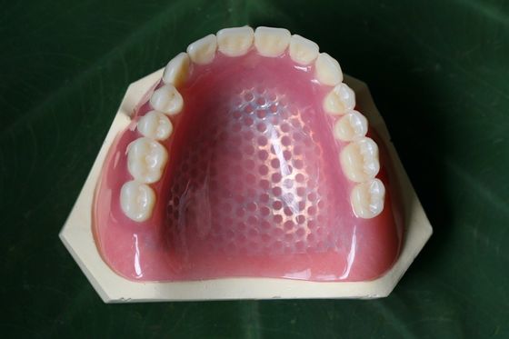 3D печатая рамки металла Denture скелета металла частично