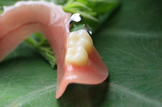 Частично съемный акриловый частично Denture