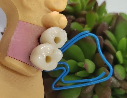Зубные имплантаты Endosseous увенчивают