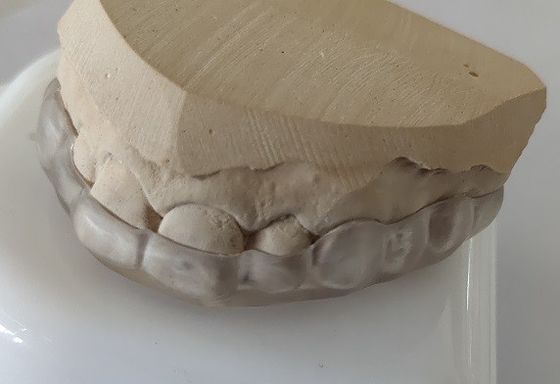 Esthetics понижает рупор свода для обхватывать зубов