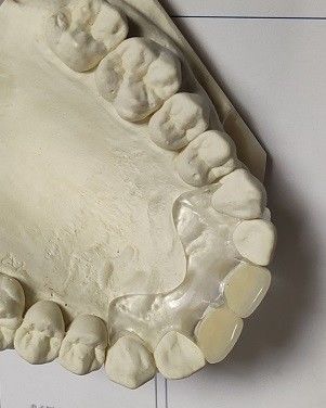 Удобный Denture пригонки ISO13485 RPD мягкий невидимый