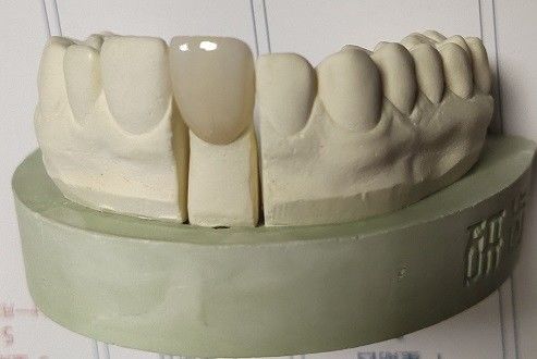 Zirconia преграждает зубоврачебную печать 3D фрезерованием кулачков CAD
