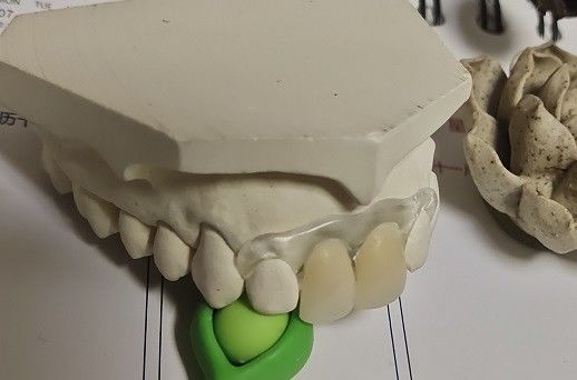 Временный мягкий и эластичный Denture Valplast невидимый