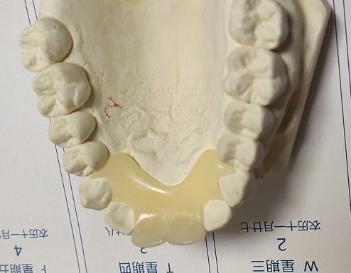 Denture Trushine мягкого эластичного нейлона невидимый