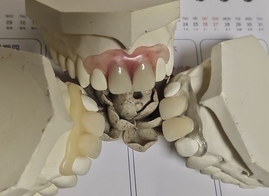 Удобный Denture пригонки ISO13485 RPD мягкий невидимый