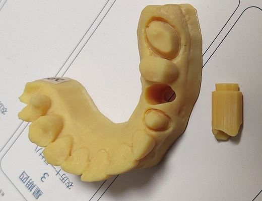 Высокая модель печати 3D точности ISO13485 Trushine зубоврачебная