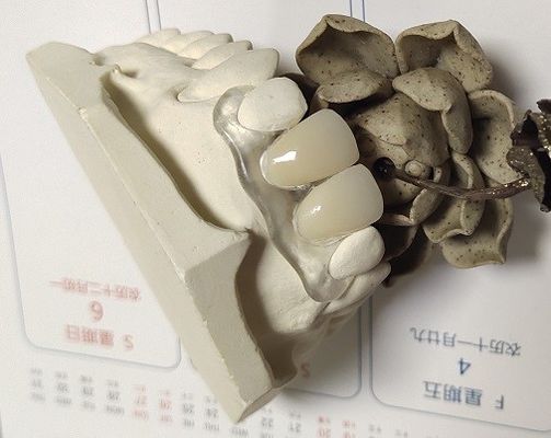 Denture Trushine мягкого эластичного нейлона невидимый