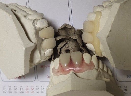 Частично гибкий невидимый Denture для Anterior зубов