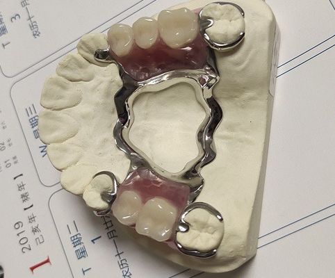 Рамки металла Denture максиллярного сплава Cr Co свода частично