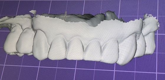 насмешка 3D цифров вверх по зубам другие зубоврачебные продукты