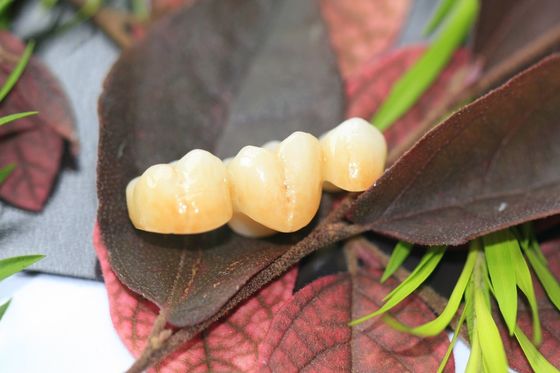 Zirconia лаборатории дизайна крона зубоврачебного монолитового зубоврачебная для зубов моляров задних