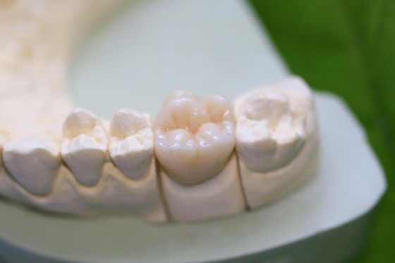 Кроны Aesthethics стеклянные керамические EMAX задние для моляров