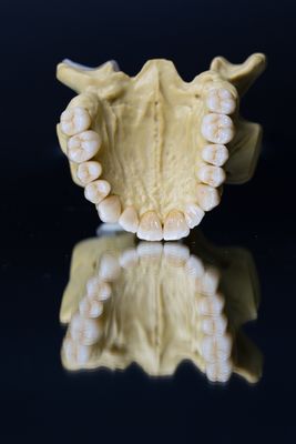 Esthetics звезд кроны 5 зубоврачебного Zirconia фарфора лаборатории зубоврачебный