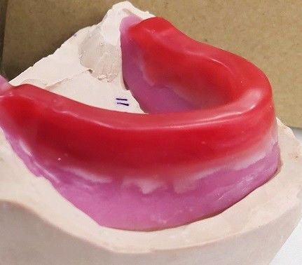 Блоки Trushine зубоврачебные рекордные для окончательных полных Dentures