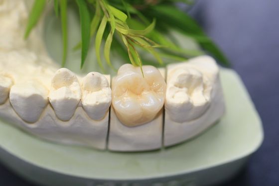 Zirconia лаборатории дизайна крона зубоврачебного монолитового зубоврачебная для зубов моляров задних